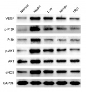 Western Blot